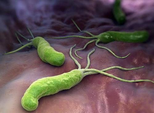 幽门螺杆菌咬烂你的胃黏膜,常吃这3物,胃病口