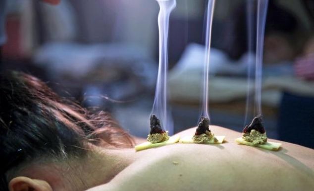 艾灸两年后死亡