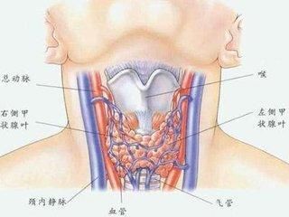 甲状腺结节癌变前有哪些征兆