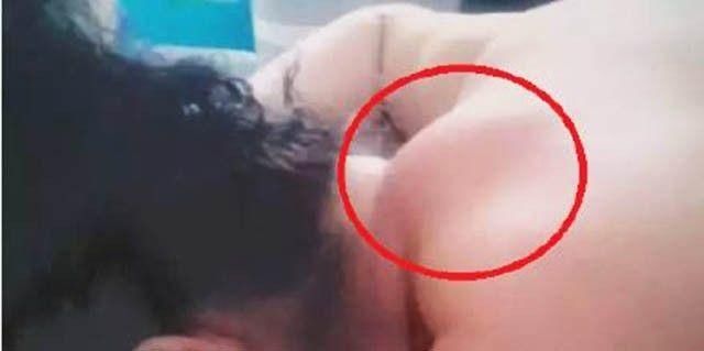 总感觉颈后有大包,怎么回事,如何去掉?