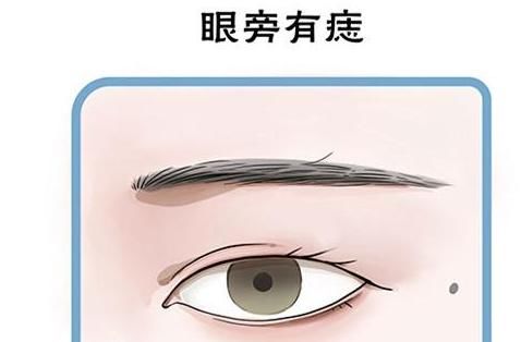 痣相解析:眼睛周围有痣代表什么?吉凶主要看颜