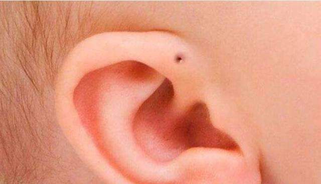 孩子一个耳朵