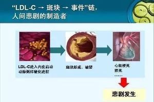 科普 | 心血管医生:血脂五项化验单要这么看，才准!