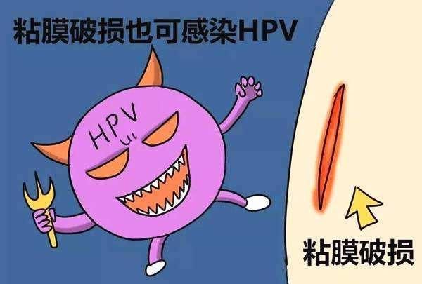 打宫颈疫苗就不会hpv了吗