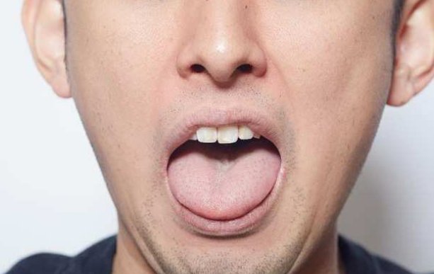 舌苔有这些情况, 都是不健康的表现! 快伸出舌