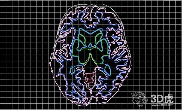 Aether宣布人工智能三维医疗成像软件的新更新