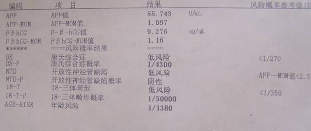 唐氏人口数_唐氏综合症图片(3)