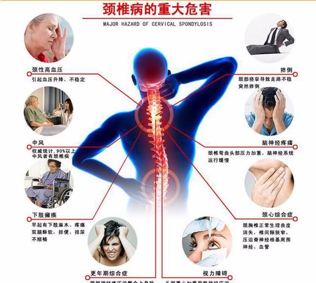 颈椎病别乱吃药!这个方法坚持7天,颈椎病不再