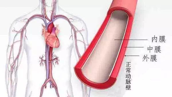 【健康】打个喷嚏也会要命?小心你血管里这颗\＂不定时炸弹\＂!