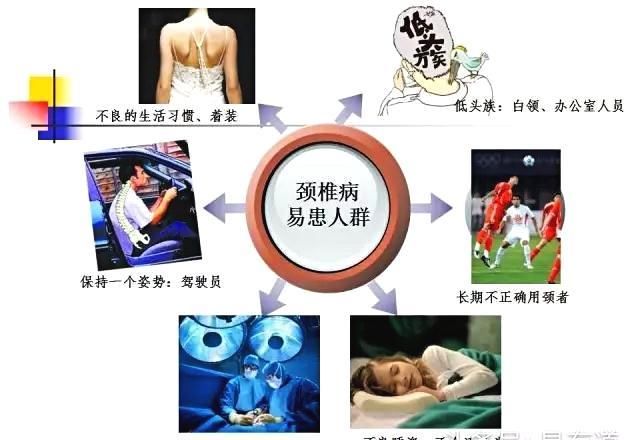 你知道颈椎病的类型吗?看完这些图,赶紧对照一