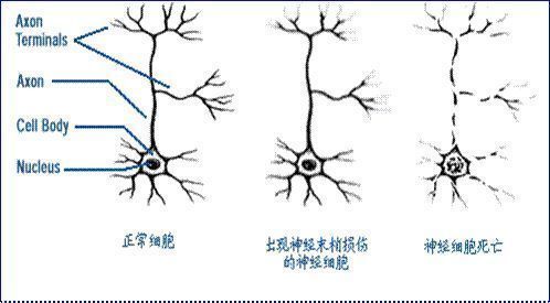 阳泉禁毒:合成毒品对大脑中枢神经的损害不可