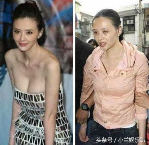 明星吸毒前后对比,女神变丑女,最后一位离世,网友:吸毒毁一生!