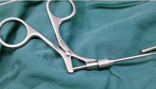 体内现一把手术钳是怎么回事:体内手术钳怎么