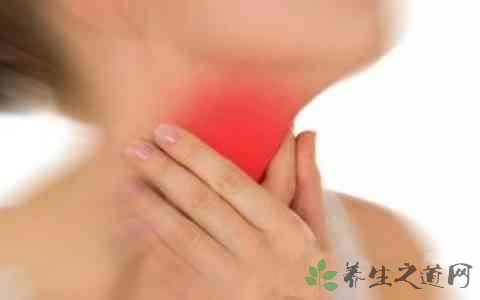 治疗慢性咽炎药有哪些