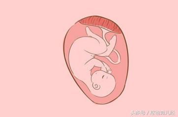 的女人怀孕要注意了,很容易造成新生儿溶血症
