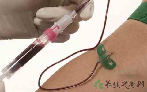 血液检查能查出艾滋病