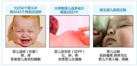 别急!宝宝湿疹怎么办?3步学习，新生儿妈妈看过来!为孩子转