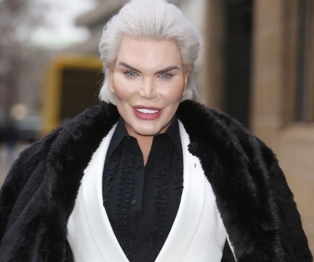 吸脂激光漂白,男子花费40多万欲将自己变精灵