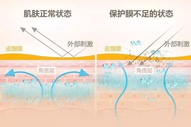 原因是皮脂膜受損,水分流失加速毛囊堵塞,水油失衡,油脂分泌量增加.